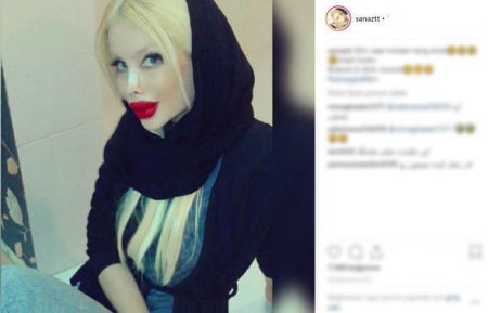 “Eşşək qulağı” və “pişik gözü” tipli estetik əməliyyat etdiən İran qızları-FOTOLAR