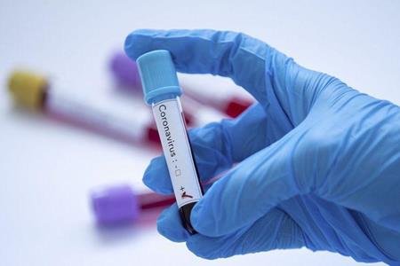 “İranda 3,5 milyon insan koronavirusdan öləcək“