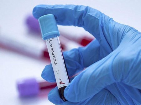 Qırğızıstanda koronavirusa daha 25 nəfər yoluxub