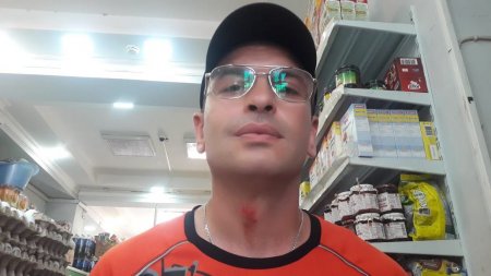 Xırdalan sakini: İcra nümayəndəsi işçiləriylə birləşib məni döydü
