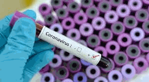 Nəhəng şirkətlərdə koronavirus həyəcanı – İşçilərinə işə gəlməmək və səyahət yasağı qoydular