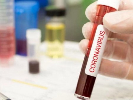 Türkiyədə gizli yas mərasimində 163 nəfər koronavirusa yoluxdu