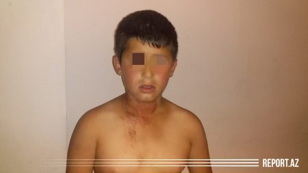 Ata dilənmək istəməyən 11 yaşlı oğlunu başından bıçaqladı - BAKIDA DƏHŞƏT