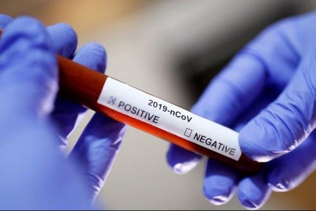Daha 478 nəfərdə koronavirus aşkarlandı, 7 nəfər vəfat etdi, 369 sağaldı