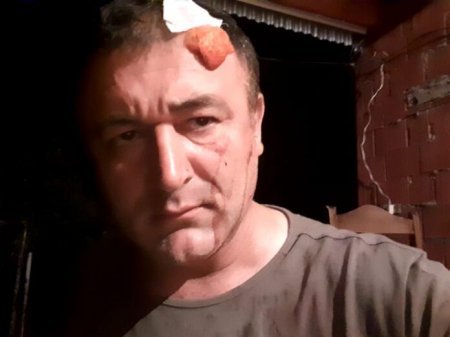 FHN-nin işçisi deputatın nümayəndəsinin başını yardı