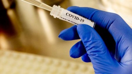 Digər ölkələrdə pulsuz, Azərbaycanda 100 manat: - “Test qiyməti bilərəkdən  ...