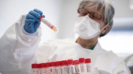 Axşamın BƏD XƏBƏRİ: Hamımız koronavirus olacağıq, sonra...1-2 ay